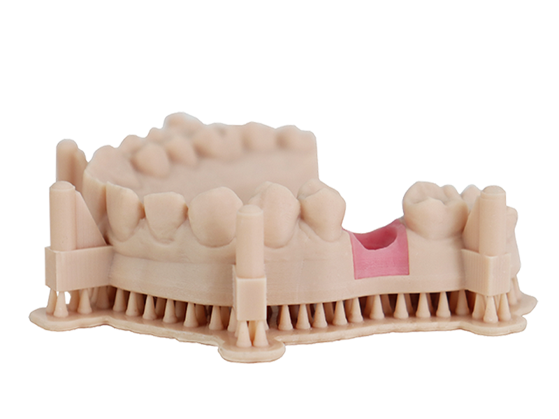 Ein mit dem Dental Model Pro Beige Harz 3D-gedrucktes Zahnmodell